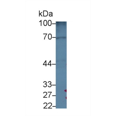 Golgi Phosphoprotein 2 (GOLPH2) Human Polyclonal Antibody