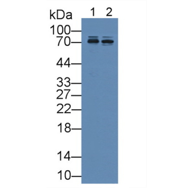 Cluster Of Differentiation 146 (CD146) Human Polyclonal Antibody