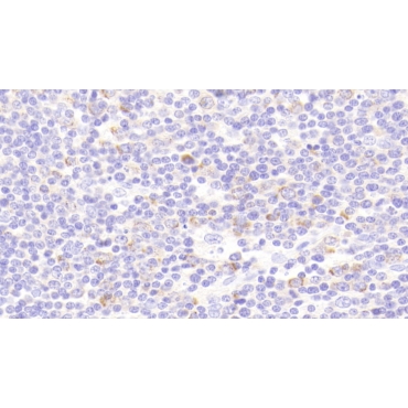 Protein Kinase, AMP Activated Beta 1 (PRKAb1) Human Polyclonal Antibody