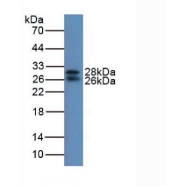 Insulin Like Growth Factor Binding Protein 7 (IGFBP7) Mouse Polyclonal Antibody