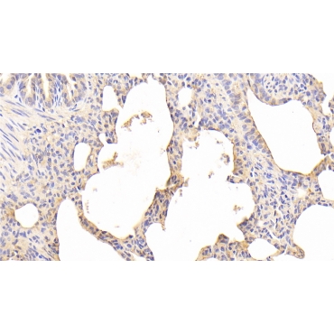 Melanotransferrin (MFI2) Human Polyclonal Antibody