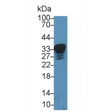 Prion Protein (PRNP) Human Polyclonal Antibody