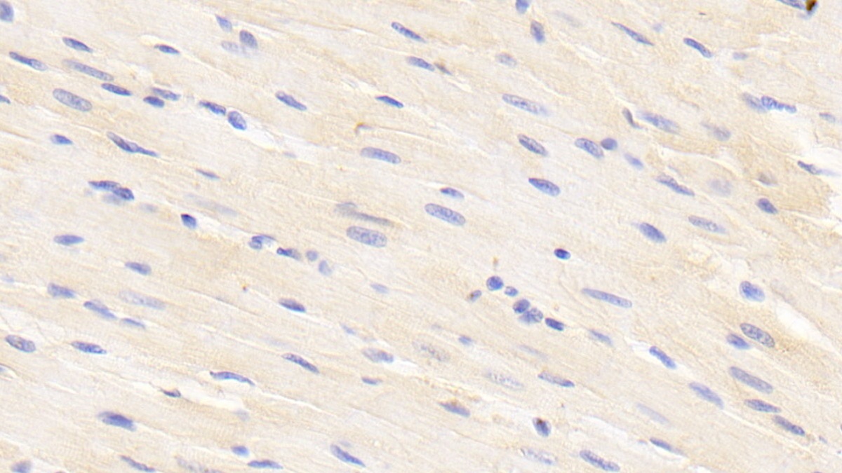 Suppressors Of Cytokine Signaling 3 (SOCS3) Rat Polyclonal Antibody