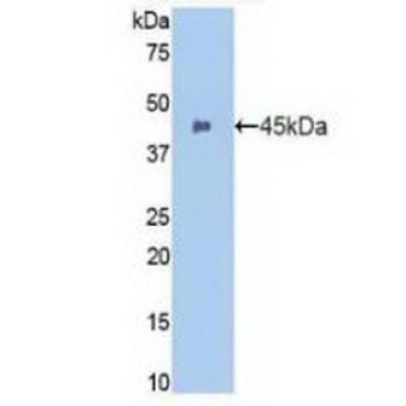 Integrin Alpha M (CD11b) Human Polyclonal Antibody