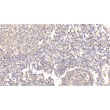Integrin Alpha M (CD11b) Human Polyclonal Antibody