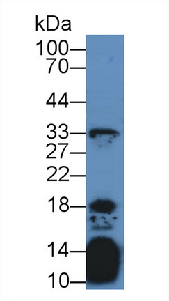 Interleukin 21 (IL21) Human Polyclonal Antibody