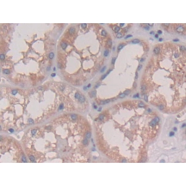 Interleukin 28A (IL28A) Human Polyclonal Antibody