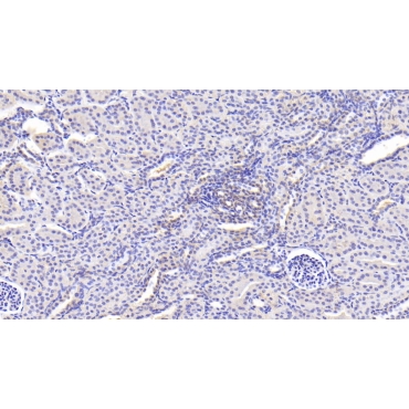Permeability Glycoprotein (Pgp) Human Polyclonal Antibody