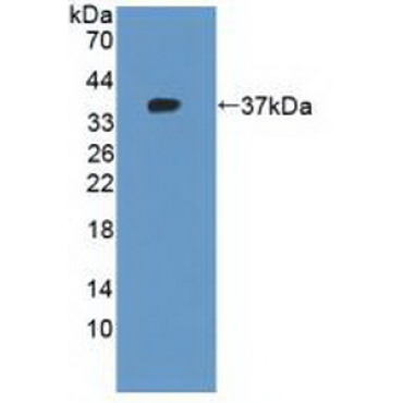 Cytokeratin 10 (CK10) Human Polyclonal Antibody