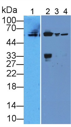 Cytokeratin 10 (CK10) Rat Polyclonal Antibody