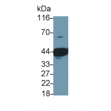 Myogenic Differentiation (MyoD) Human Polyclonal Antibody