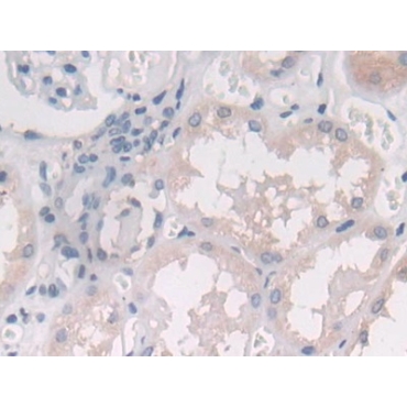 Interleukin 25 (IL25) Human Polyclonal Antibody