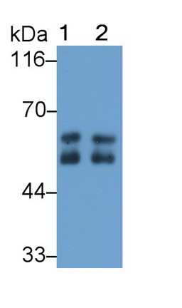 Alpha-1-Antitrypsin (a1AT) Human Polyclonal Antibody
