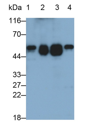 Alpha-1-Antitrypsin (a1AT) Mouse Polyclonal Antibody