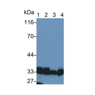 Lactate Dehydrogenase B (LDHB) Human Polyclonal Antibody