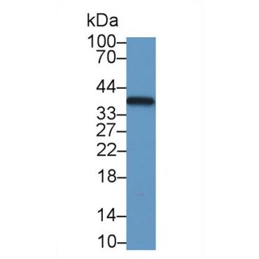 Lactate Dehydrogenase B (LDHB) Mouse Polyclonal Antibody