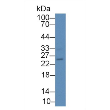Interleukin 17B (IL17B) Human Polyclonal Antibody