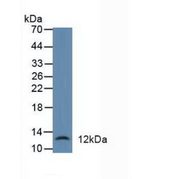 Defensin Alpha 1, Neutrophil (DEFa1) Human Polyclonal Antibody