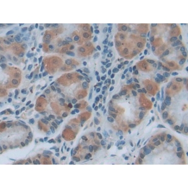 Myeloid Differentiation Factor 88 (MyD88) Mouse Polyclonal Antibody