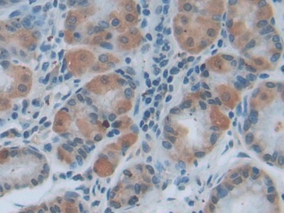 Myeloid Differentiation Factor 88 (MyD88) Mouse Polyclonal Antibody