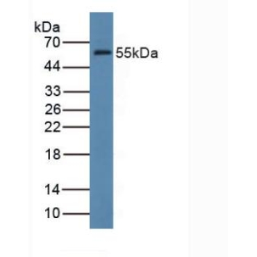 Farnesyl Diphosphate Farnesyltransferase 1 (FDFT1) Human Polyclonal Antibody
