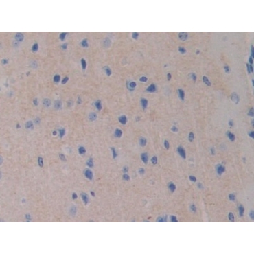Farnesyl Diphosphate Farnesyltransferase 1 (FDFT1) Mouse Polyclonal Antibody