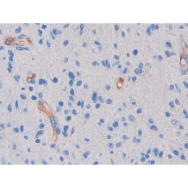 Glycocalicin (GC) Human Polyclonal Antibody