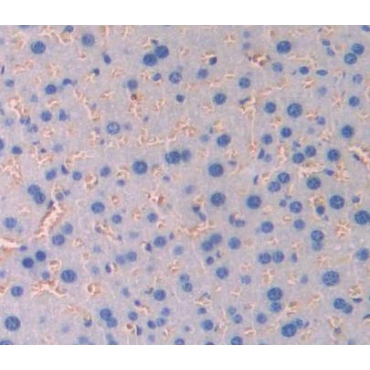 Glycophorin C (GYPC) Mouse Polyclonal Antibody