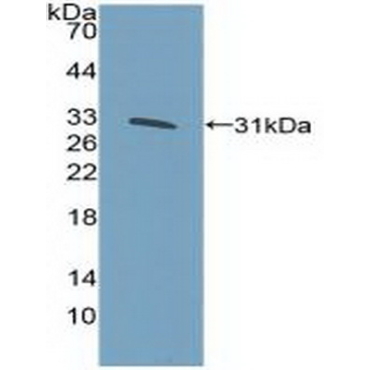 Kruppel Like Factor 5, Intestinal (KLF5) Human Polyclonal Antibody