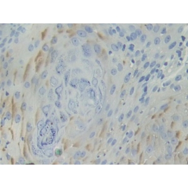Basal Cell Adhesion Molecule (BCAM) Human Polyclonal Antibody