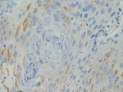 Basal Cell Adhesion Molecule (BCAM) Human Polyclonal Antibody