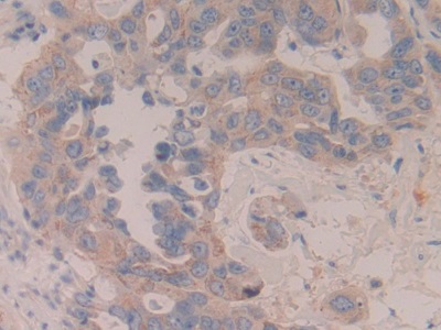 Mitogen Activated Protein Kinase Kinase 6 (MAP2K6) Human Polyclonal Antibody