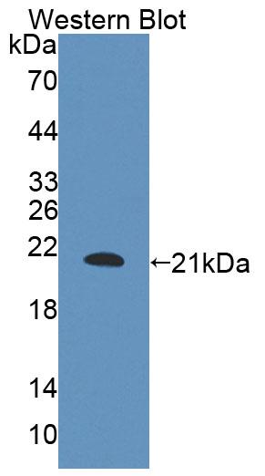 B And T-Lymphocyte Attenuator (BTLA) Rat Polyclonal Antibody