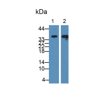 Pyridoxal Kinase (PDXK) Mouse Polyclonal Antibody