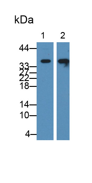 Pyridoxal Kinase (PDXK) Mouse Polyclonal Antibody