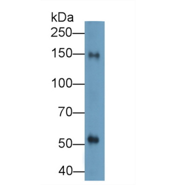 Cluster Of Differentiation (CD163) Human Polyclonal Antibody