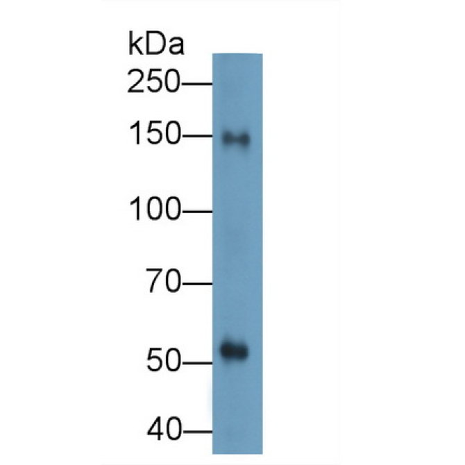 Cluster Of Differentiation (CD163) Human Polyclonal Antibody