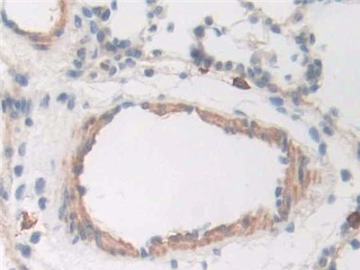 Cluster Of Differentiation (CD163) Rat Polyclonal Antibody