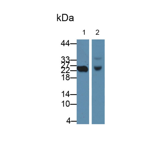 Cluster Of differentiation 301 (CD301) Human Polyclonal Antibody