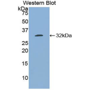 B-Cell CLL/Lymphoma 3 (Bcl3) Mouse Polyclonal Antibody
