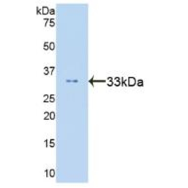 Signal Transducer And Activator Of Transcription 6 (STAT6) Human Polyclonal Antibody