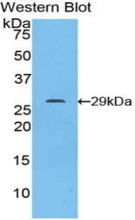Signal Transducer And Activator Of Transcription 6 (STAT6) Mouse Polyclonal Antibody