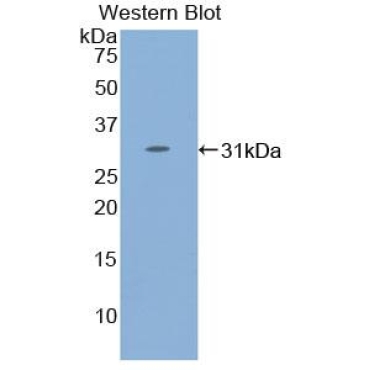 Signal Transducer And Activator Of Transcription 4 (STAT4) Human Polyclonal Antibody