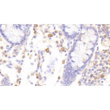 Signal Transducer And Activator Of Transcription 1 (STAT1) Human Polyclonal Antibody