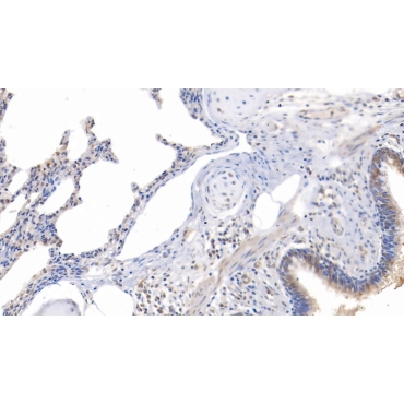 Signal Transducer And Activator Of Transcription 1 (STAT1) Human Polyclonal Antibody