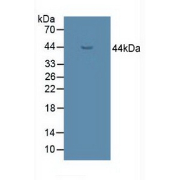 UDP Glucose Ceramide Glucosyltransferase (UGCG) Human, Mouse, Rat Polyclonal Antibody