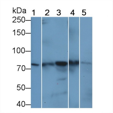 Signal Transducer And Activator Of Transcription 3 (STAT3) Human, Mouse, Rat, Bovine (Cattle) Polyclonal Antibody