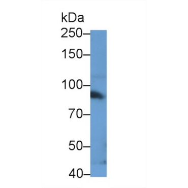 Signal Transducer And Activator Of Transcription 3 (STAT3) Human, Mouse, Rat, Bovine (Cattle) Polyclonal Antibody