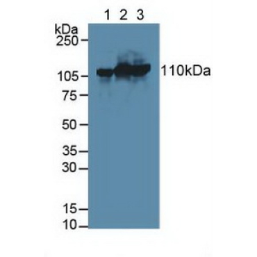 Hexokinase 3, White Cell (HK3) Human Polyclonal Antibody