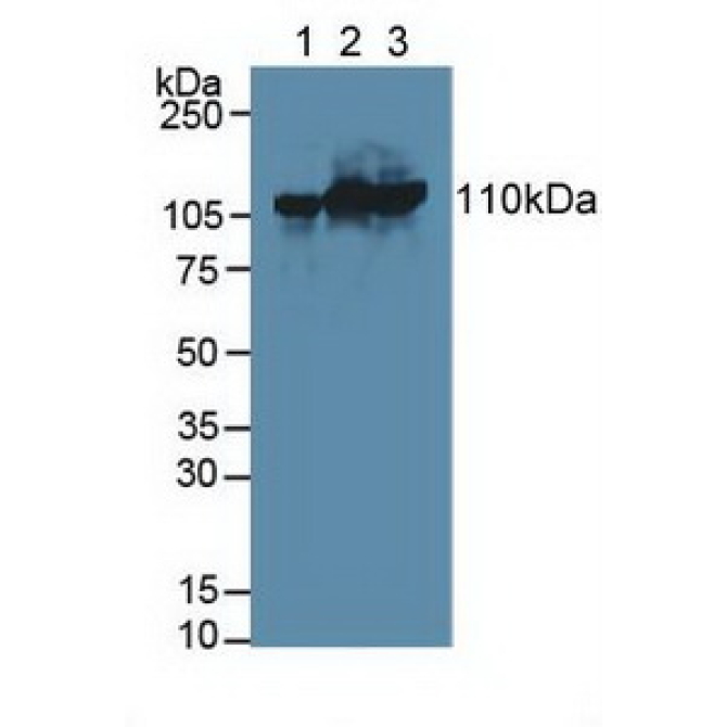 Hexokinase 3, White Cell (HK3) Human Polyclonal Antibody